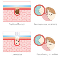 Novo Removedor digital indolor com limpeza profunda dos poros e remoção de cravos, acnes e marcas.